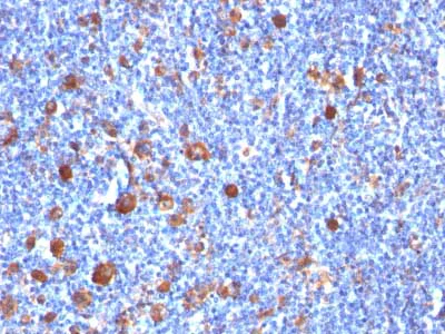 Immunohistochemistry (Formalin/PFA-fixed paraffin-embedded sections) - Anti-Fascin antibody [SPM133] - BSA and Azide free (AB212841)