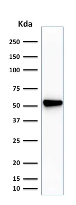 Western blot - Anti-Fascin antibody [SPM133] - BSA and Azide free (AB212841)
