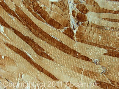 Immunohistochemistry (Formalin/PFA-fixed paraffin-embedded sections) - Anti-Fast Myosin Skeletal Heavy chain antibody (AB91506)