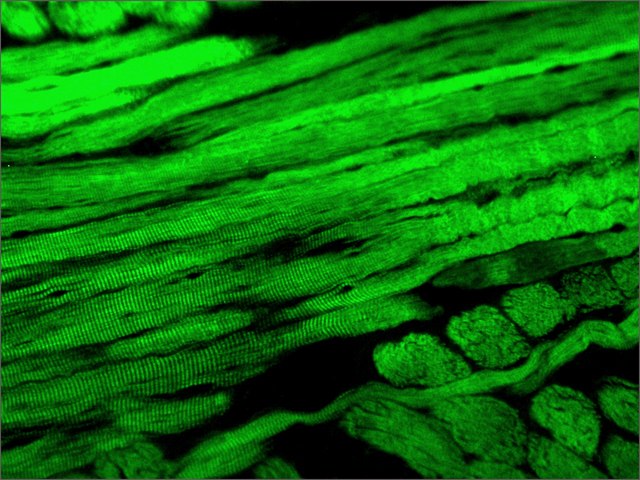 Anti-Fast Myosin Skeletal Heavy chain antibody [MY-32]