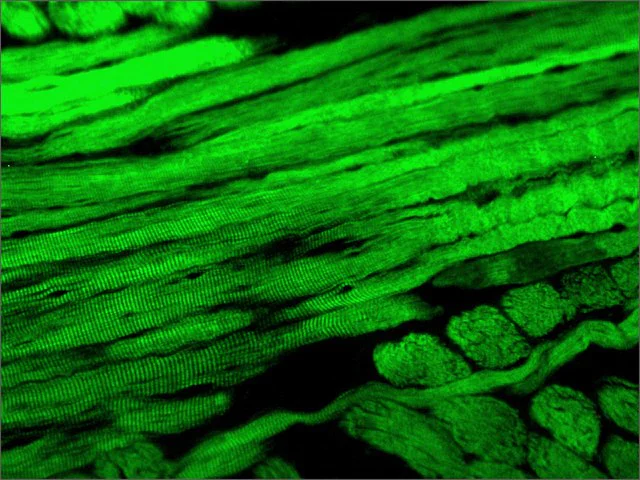 Immunohistochemistry (Formalin/PFA-fixed paraffin-embedded sections) - Anti-Fast Myosin Skeletal Heavy chain antibody [MY-32] (AB51263)