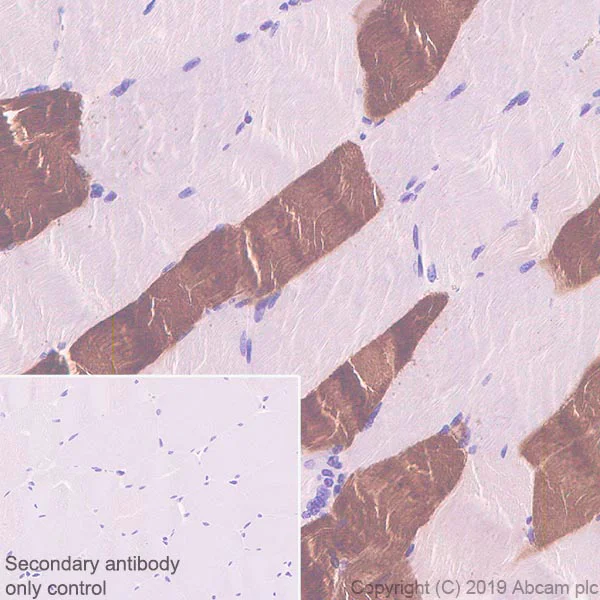 Immunohistochemistry (Formalin/PFA-fixed paraffin-embedded sections) - Anti-Fast Myosin Skeletal Heavy chain + MYH4 antibody [EPR22880-64] (AB221149)