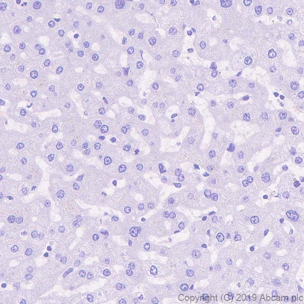 Immunohistochemistry (Formalin/PFA-fixed paraffin-embedded sections) - Anti-Fast Myosin Skeletal Heavy chain + MYH4 antibody [EPR22880-64] (AB221149)