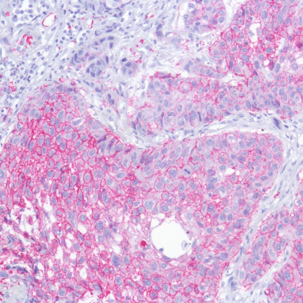 Immunohistochemistry (Formalin/PFA-fixed paraffin-embedded sections) - Fast Red Substrate Kit (AB64254), expandable thumbnail