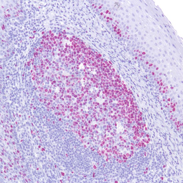 Immunohistochemistry (Formalin/PFA-fixed paraffin-embedded sections) - Fast Red Substrate Kit (AB64254), expandable thumbnail