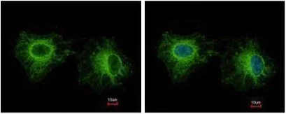Immunocytochemistry/ Immunofluorescence - Anti-fast skeletal Myosin antibody (AB228727)