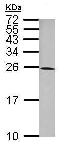 Western blot - Anti-fast skeletal Myosin antibody (AB228727)