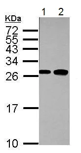 Western blot - Anti-fast skeletal Myosin antibody (AB228727)