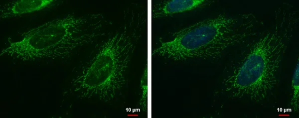 Immunocytochemistry/ Immunofluorescence - Anti-FASTK antibody (AB97544)
