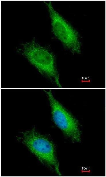 Immunocytochemistry/ Immunofluorescence - Anti-FASTK antibody (AB97544)