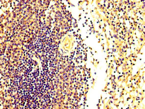 Immunohistochemistry (Formalin/PFA-fixed paraffin-embedded sections) - Anti-FASTKD2 antibody (AB235113)