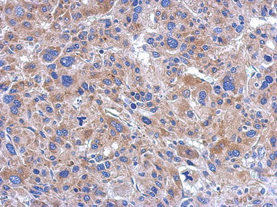 Immunohistochemistry (Formalin/PFA-fixed paraffin-embedded sections) - Anti-FASTKD5 antibody (AB111548), expandable thumbnail