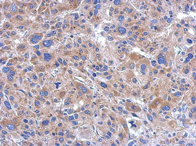 Immunohistochemistry (Formalin/PFA-fixed paraffin-embedded sections) - Anti-FASTKD5 antibody (AB111548)
