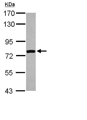Western blot - Anti-FASTKD5 antibody (AB111548), expandable thumbnail