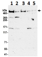 Western blot - Anti-FAT/FAT1 antibody (AB190242)