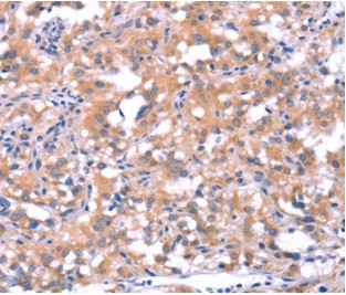 Immunohistochemistry (Formalin/PFA-fixed paraffin-embedded sections) - Anti-FAT/FAT1 antibody (AB198892), expandable thumbnail