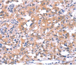 Immunohistochemistry (Formalin/PFA-fixed paraffin-embedded sections) - Anti-FAT/FAT1 antibody (AB198892)