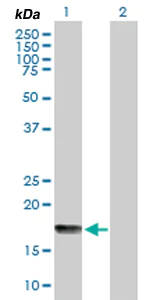 Western blot - Anti-FAT10 antibody (AB168680)