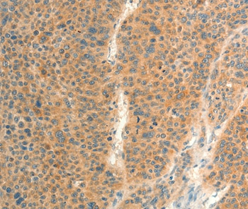 Immunohistochemistry (Formalin/PFA-fixed paraffin-embedded sections) - Anti-FAT3 antibody (AB198861), expandable thumbnail
