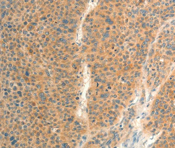 Immunohistochemistry (Formalin/PFA-fixed paraffin-embedded sections) - Anti-FAT3 antibody (AB198861)
