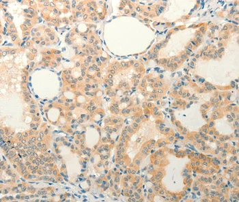 Immunohistochemistry (Formalin/PFA-fixed paraffin-embedded sections) - Anti-FAT3 antibody (AB198861)