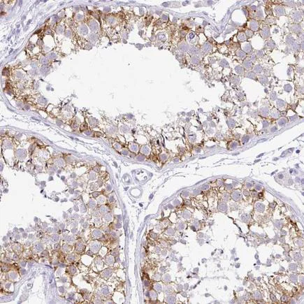 Immunohistochemistry (Formalin/PFA-fixed paraffin-embedded sections) - Anti-FATE1 antibody (AB223720)