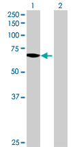 Western blot - Anti-FATP1 antibody (AB69458)
