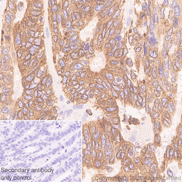 Immunohistochemistry (Formalin/PFA-fixed paraffin-embedded sections) - Anti-FATP2 antibody [EPR29808-543] - BSA and Azide free (AB326591)