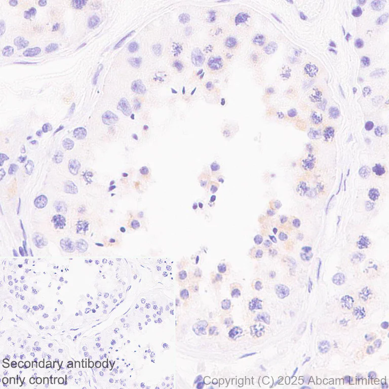 Immunohistochemistry (Formalin/PFA-fixed paraffin-embedded sections) - Anti-FATP2 antibody [EPR29808-543] - BSA and Azide free (AB326591)