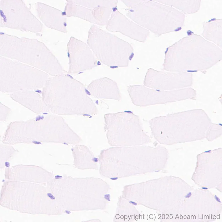 Immunohistochemistry (Formalin/PFA-fixed paraffin-embedded sections) - Anti-FATP2 antibody [EPR29808-543] - BSA and Azide free (AB326591)