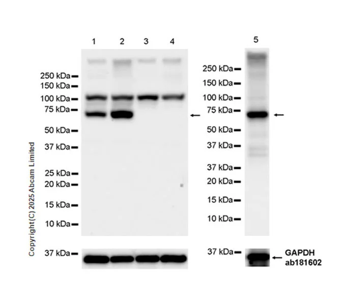Western blot - Anti-FATP2 antibody [EPR29808-543] - BSA and Azide free (AB326591)