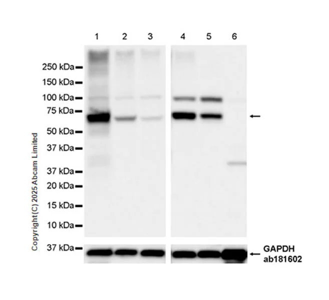 Western blot - Anti-FATP2 antibody [EPR29808-543] - BSA and Azide free (AB326591)
