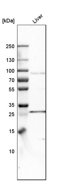 Western blot - Anti-FATP3 antibody (AB262939)