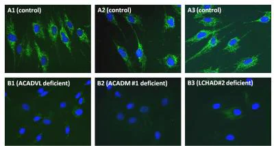 Immunocytochemistry/ Immunofluorescence - Fatty Acid Oxidation Assay Kit (flow cytometry) (AB118183)