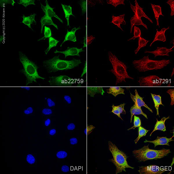Immunocytochemistry - Anti-Fatty Acid Synthase antibody (AB22759)