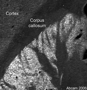 Immunohistochemistry (PFA fixed) - Anti-Fatty Acid Synthase antibody (AB22759)