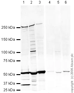 Western blot - Anti-Fatty Acid Synthase antibody (AB22759)