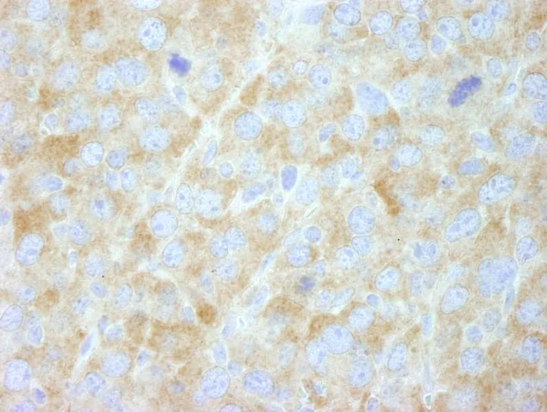 Immunohistochemistry (Formalin/PFA-fixed paraffin-embedded sections) - Anti-Fatty Acid Synthase antibody (AB264428)