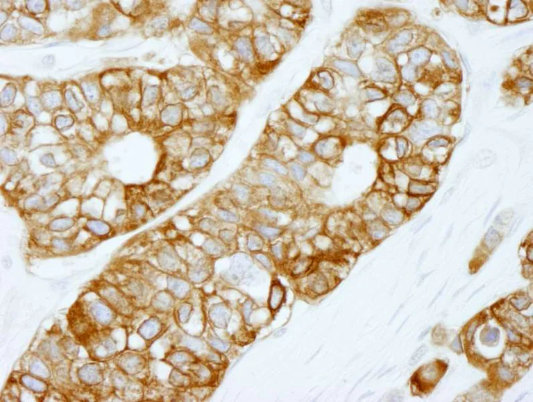 Immunohistochemistry (Formalin/PFA-fixed paraffin-embedded sections) - Anti-Fatty Acid Synthase antibody (AB264428)