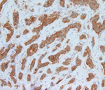 Immunohistochemistry (Formalin/PFA-fixed paraffin-embedded sections) - Anti-Fatty Acid Synthase antibody (AB99359)
