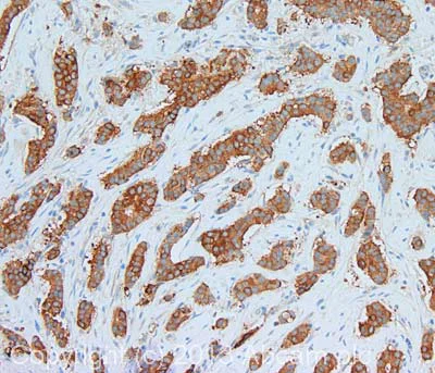 Immunohistochemistry (Formalin/PFA-fixed paraffin-embedded sections) - Anti-Fatty Acid Synthase antibody (AB99359)