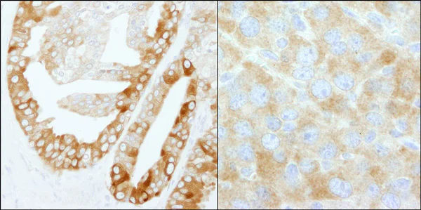 Immunohistochemistry (Formalin/PFA-fixed paraffin-embedded sections) - Anti-Fatty Acid Synthase antibody (AB99359)