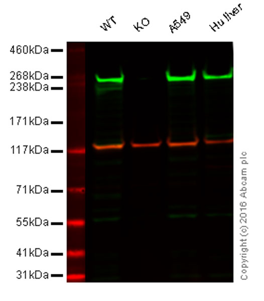 Western blot - Anti-Fatty Acid Synthase antibody [EPR7465] (AB128856), expandable thumbnail