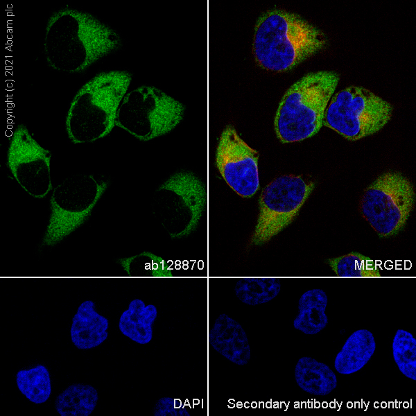 Immunocytochemistry/ Immunofluorescence - Anti-Fatty Acid Synthase antibody [EPR7466] (ab128870), expandable thumbnail