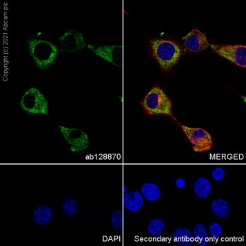 Immunocytochemistry/ Immunofluorescence - Anti-Fatty Acid Synthase antibody [EPR7466] (ab128870), expandable thumbnail