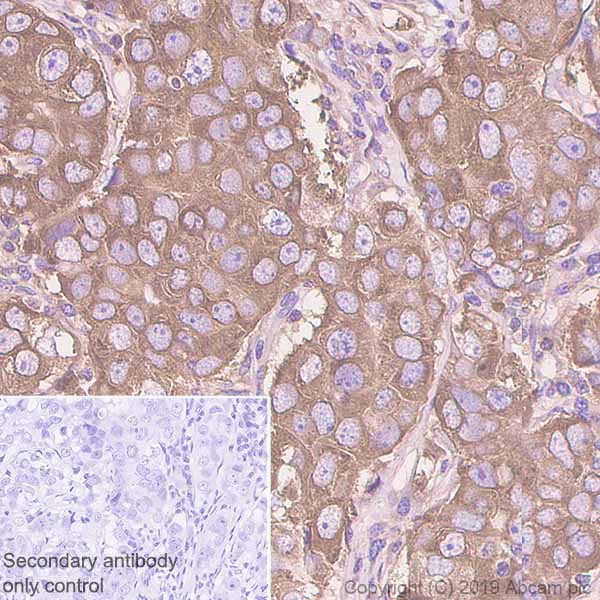 Immunohistochemistry (Formalin/PFA-fixed paraffin-embedded sections) - Anti-Fatty Acid Synthase antibody [EPR7466] (AB128870), expandable thumbnail