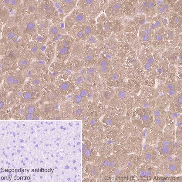 Immunohistochemistry (Formalin/PFA-fixed paraffin-embedded sections) - Anti-Fatty Acid Synthase antibody [EPR7466] (AB128870), expandable thumbnail