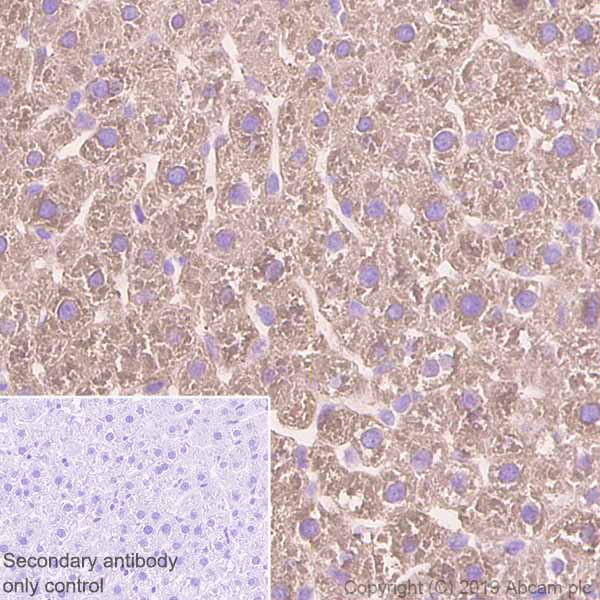 Immunohistochemistry (Formalin/PFA-fixed paraffin-embedded sections) - Anti-Fatty Acid Synthase antibody [EPR7466] (ab128870), expandable thumbnail