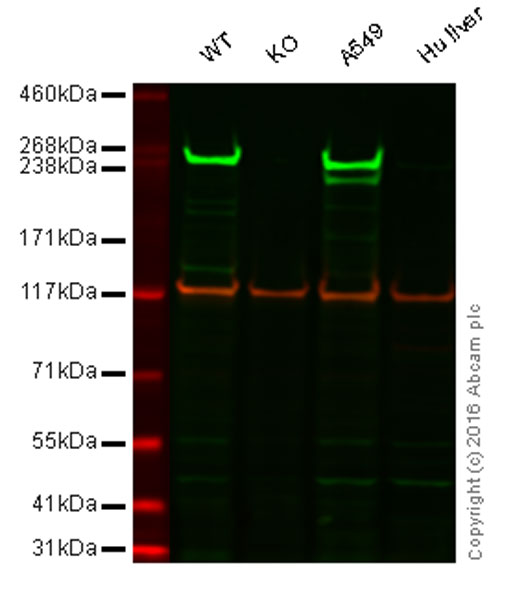 Western blot - Anti-Fatty Acid Synthase antibody [EPR7466] (ab128870), expandable thumbnail