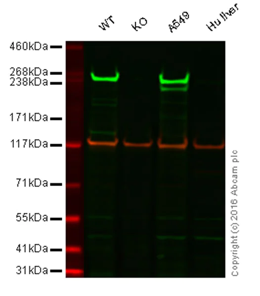 Western blot - Anti-Fatty Acid Synthase antibody [EPR7466] (AB128870)
